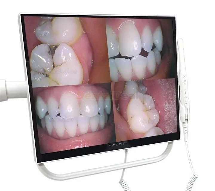 Magenta YFHD-D Intraoral Camera with 17 Inch Monitor & Bracket 1/4 sony CCD